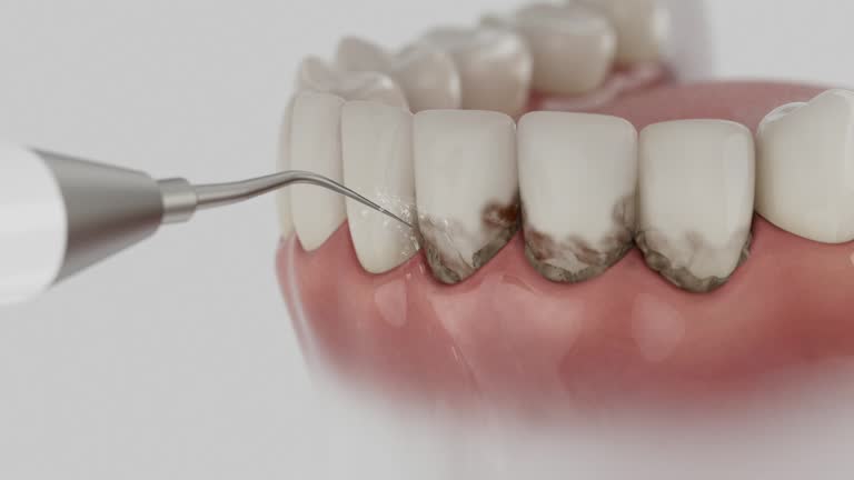 Trusted Tooth Extraction service in Garnett, KS - Dentist Open Now